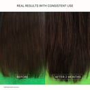 ACTIIV Renew Conditioner, 7 oz