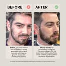 ACTIIV Growth Beard Oil Unscented, 1 oz