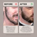 ACTIIV Growth Beard Oil Classic, 1 oz